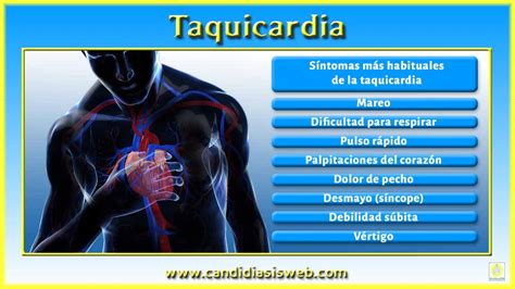 la taquicardia es peligrosa-4